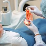 signs you need a root canal treatment