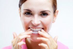 Dental Guards Everything You Need To Know
