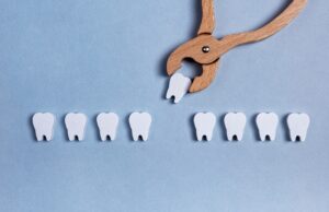 Do You Need to Have Your Wisdom Teeth Removed?