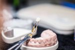 how-does-restorative-dentistry-help-prevent-further-dental-problems
