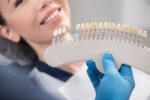 How Often To Get Professional Teeth Whitening