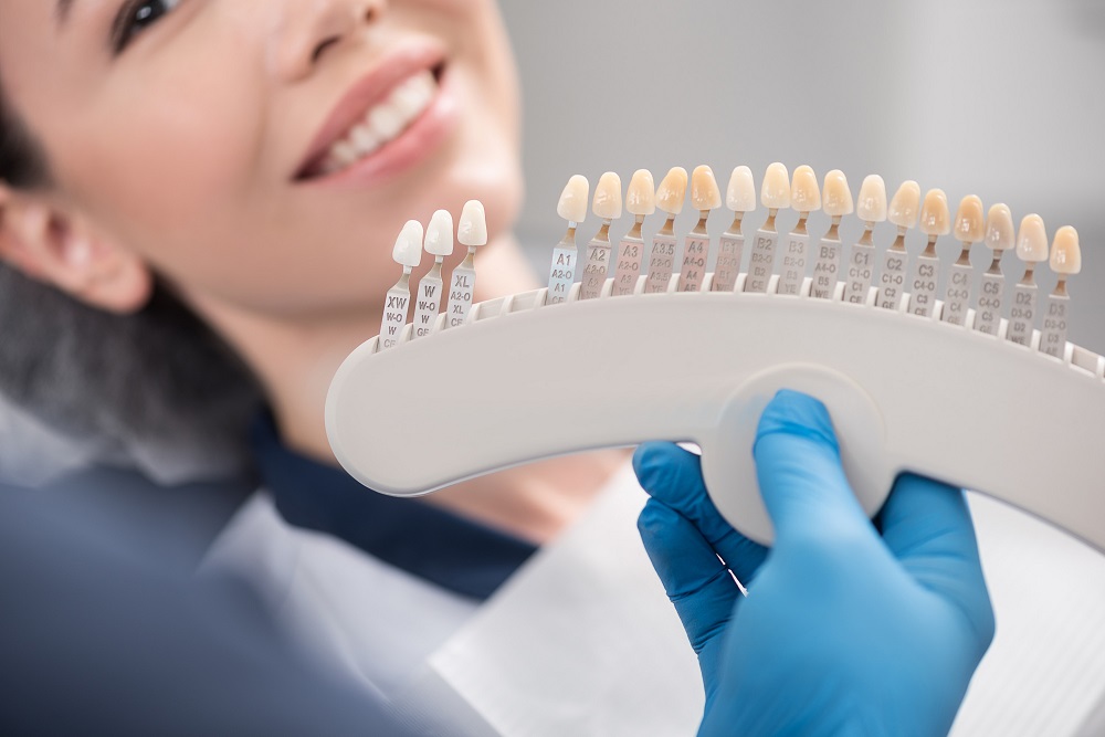 How Often To Get Professional Teeth Whitening