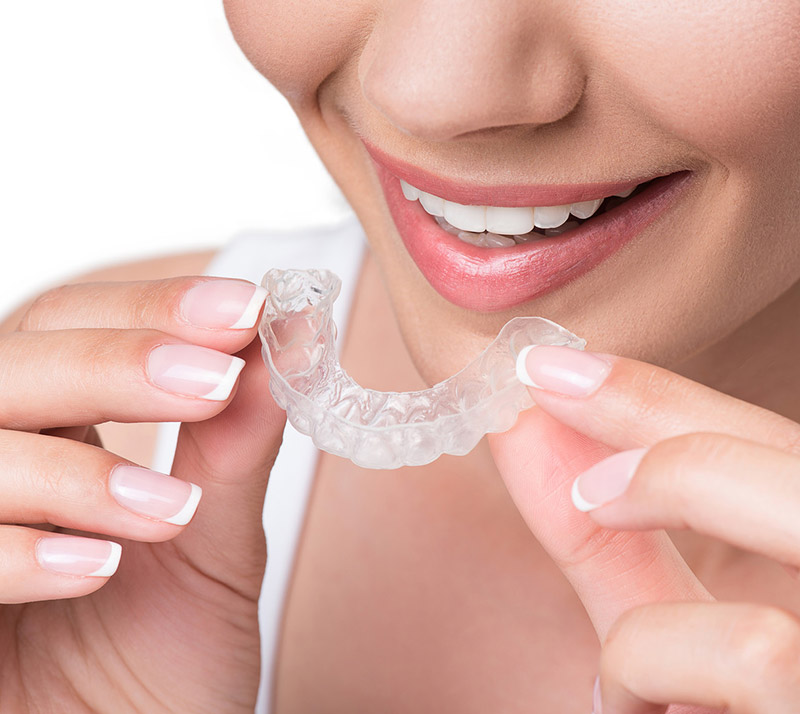 invisalign in sidney